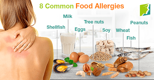 All About Food Allergies